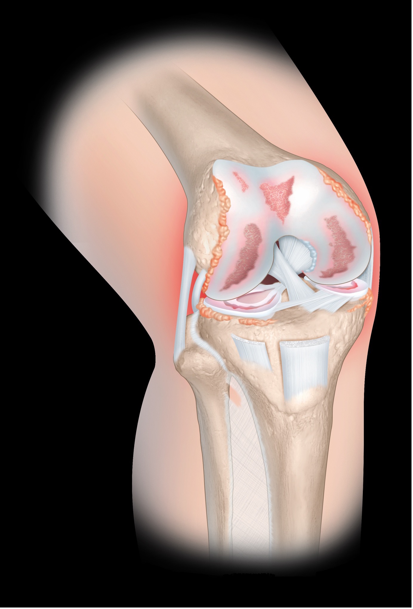 Knie